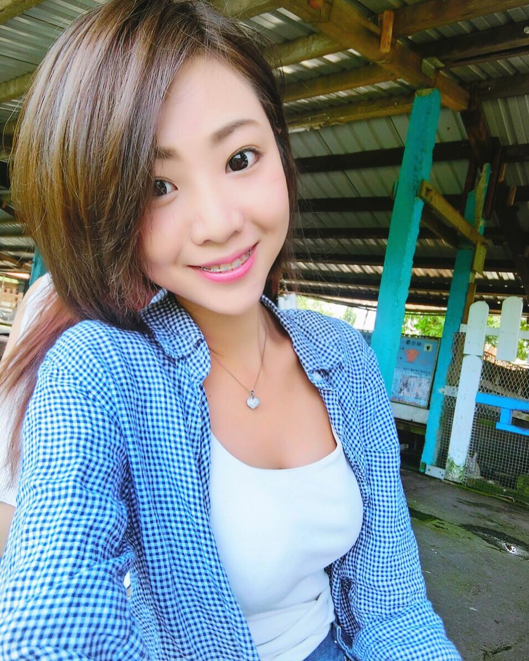 林舒舒- 短发牙套妹子也有好身材